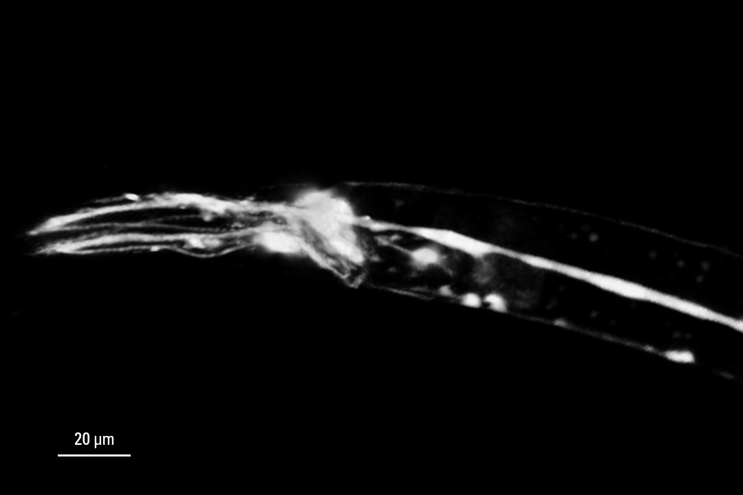 线虫神经元的三维共聚焦图像