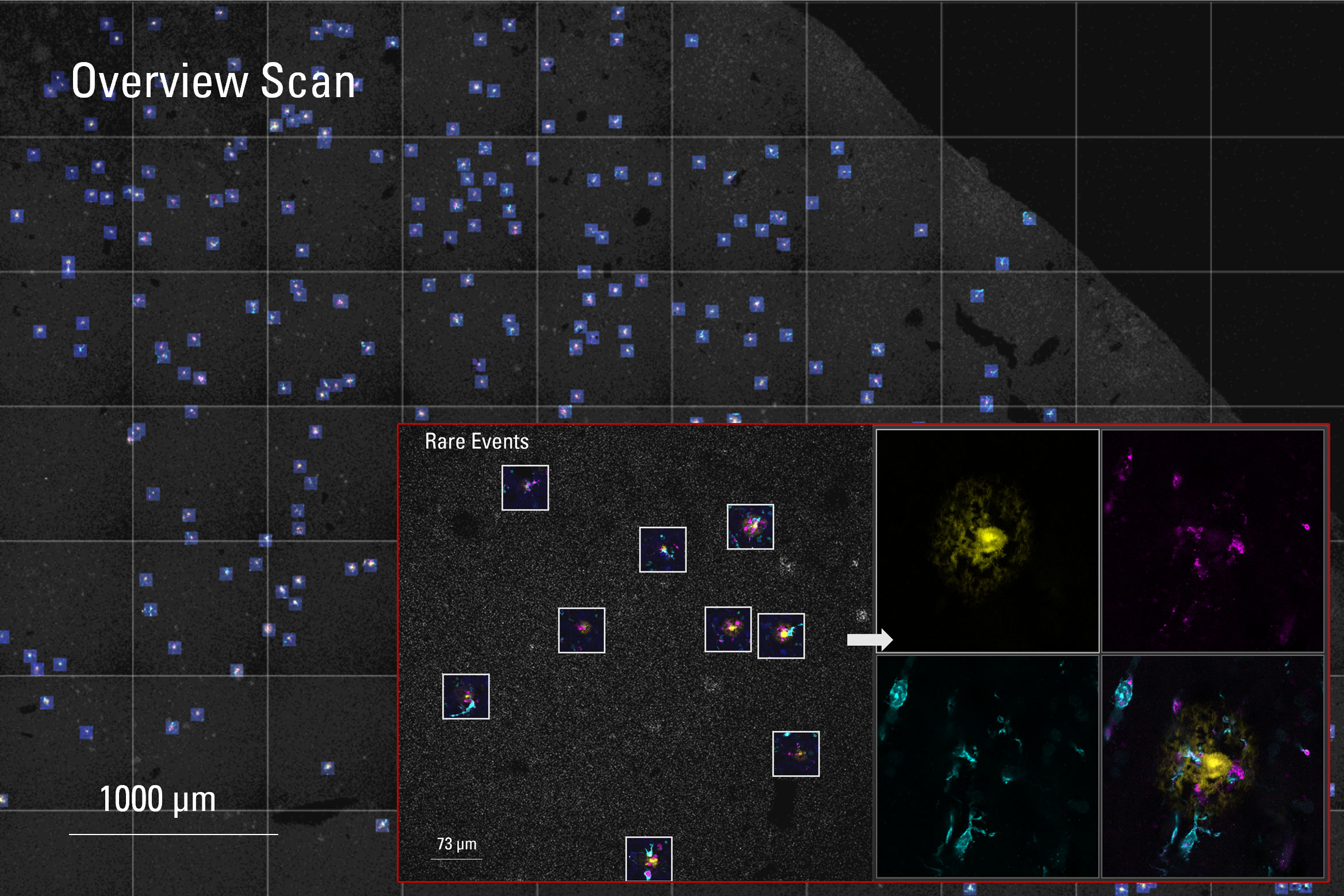 Images of 50-µm-thick human-brain sections (Alzheimer disease donors) 