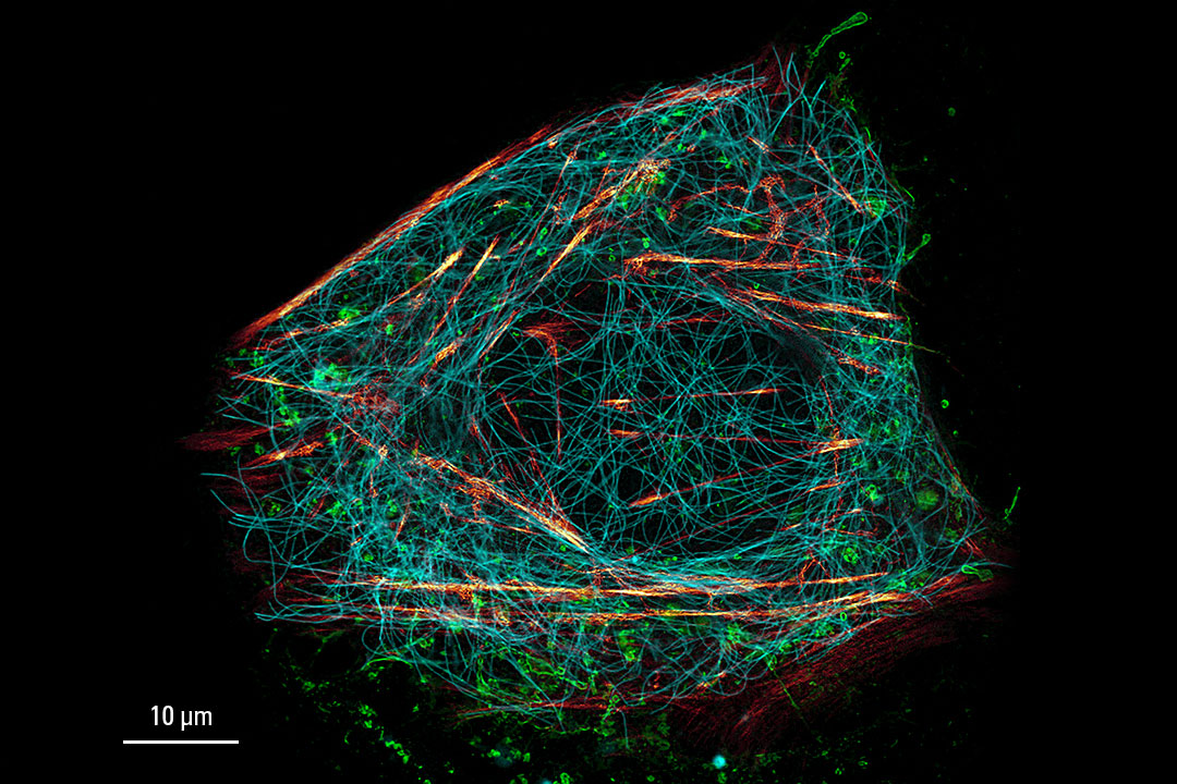 [Translate to chinese:] Live cell TauSTED on U2OS cells - sted