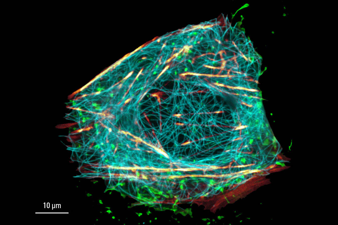 [Translate to chinese:] Live cell TauSTED on U2OS cells - confocal