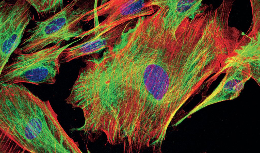 [Translate to chinese:] Mouse fibroblasts-Green: F-Actin, FITC-Red: Tubulin, Cy5-Blue: Nuclei, DAPIC ourtesy of Dr. Günter Giese, Max Planck Institute for Medical Research, Heidelberg, Germany